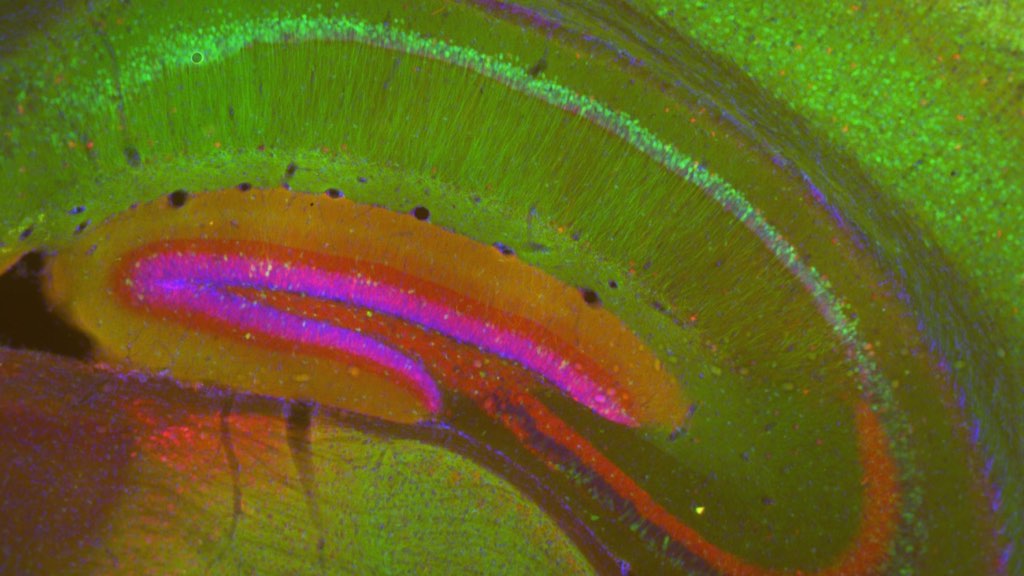 MDMA & Psilocybin for PTSD: The Myelin&nbsp;Clue