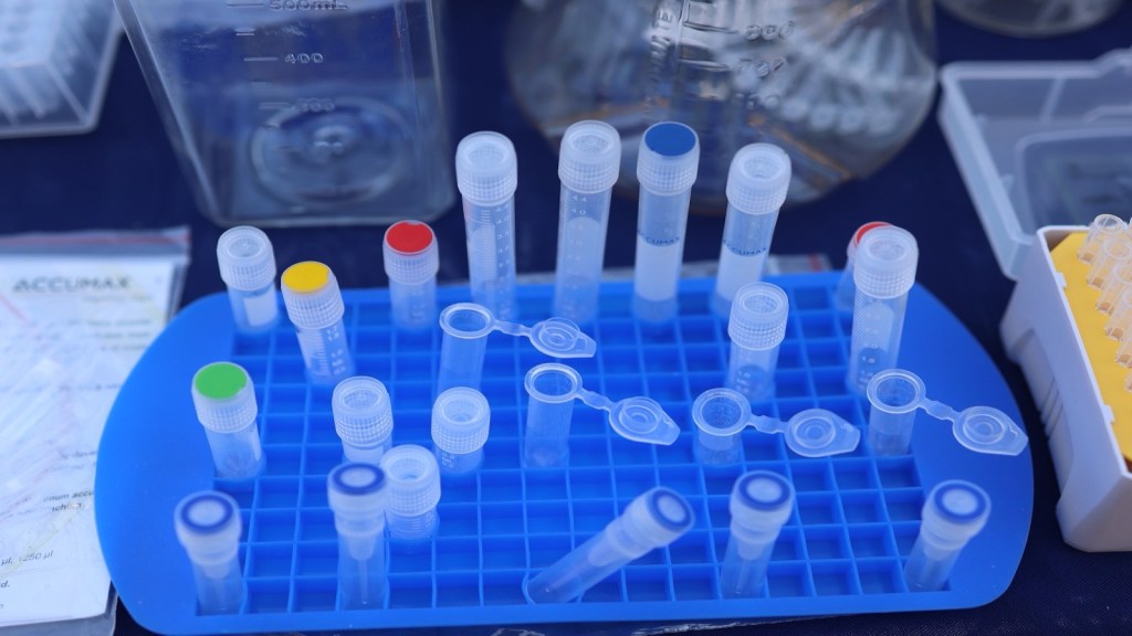 Alzheimer’s Blood Test: What the Result Can Tell You