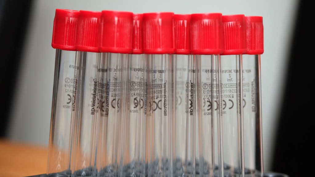 The Lipoprotein A Test Almost Nobody&nbsp;Gets