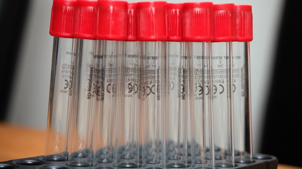Organ Age Test: What One Blood Draw Really&nbsp;Shows