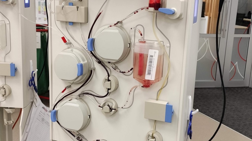 Plasma Exchange Longevity: What One 42-Person Trial&nbsp;Shows